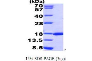 SDS-PAGE (SDS) image for Runt-Related Transcription Factor 3 (RUNX3) (AA 53-186) protein (His tag) (ABIN7279042)