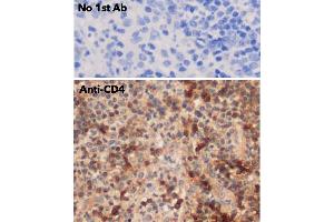 Immunohistochemistry (IHC) image for anti-CD4 (CD4) antibody (ABIN6254232)