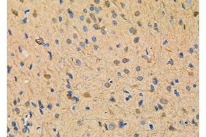 ABIN6263563 and ABIN6278011 at 1/100 staining Rat brain tissue by IHC-P.