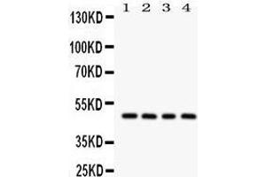Western Blotting (WB) image for anti-serpin Peptidase Inhibitor, Clade A (Alpha-1 Antiproteinase, Antitrypsin), Member 1 (SERPINA1) (AA 211-411) antibody (ABIN3043431) (SERPINA1 antibody  (AA 211-411))