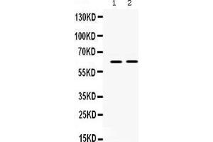 Observed bind size: 63KD (LOXL1 antibody  (C-Term))