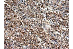 Image no. 8 for anti-Aminoacylase 1 (ACY1) antibody (ABIN1496454) (Aminoacylase 1 antibody)