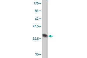 Western Blot detection against Immunogen (37 KDa) . (ACVR2B antibody  (AA 21-120))