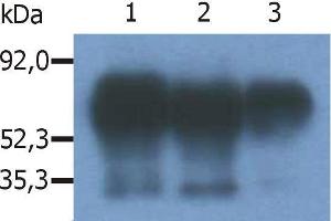 Immunoprecipitation of human PAG/Cbp from the lysate of RAJI human Burkitt lymphoma cell line. (PAG1 antibody  (C-Term))