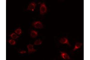 ABIN6275973 staining Hela by IF/ICC. (BAI1 antibody  (Internal Region))