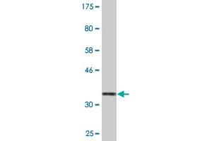 Western Blot detection against Immunogen (35. (TAO Kinase 3 antibody  (AA 809-898))