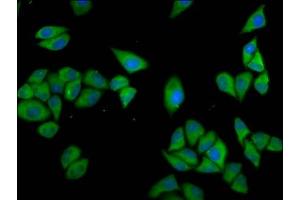 Immunofluorescence staining of Hela cells with ABIN7147569 at 1:133, counter-stained with DAPI. (CLCC1 antibody  (AA 446-551))