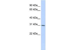 WB Suggested Anti-WDR33  Antibody Titration: 0. (WDR33 antibody  (Middle Region))