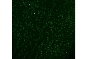 IF analysis of DDX1 using anti-DDX1 antibody (ABIN7602052). (DDX1 antibody  (AA 562-740))