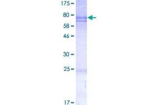 CDCA7 Protein (AA 1-371) (GST tag)