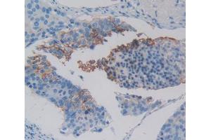IHC-P analysis of Kidney tissue, with DAB staining. (XCR1 antibody  (AA 43-222))