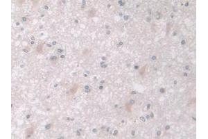 Immunohistochemistry (IHC) image for anti-Mitogen-Activated Protein Kinase 12 (MAPK12) (AA 27-311) antibody (ABIN7441064)