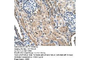 Human kidney (FLJ22167 (N-Term) antibody)