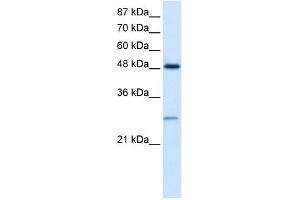 WB Suggested Anti-CLIC4 Antibody Titration:  2. (CLIC4 antibody  (N-Term))