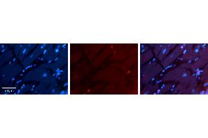 Rabbit Anti-RING1 Antibody Catalog Number: ARP33227_P050 Formalin Fixed Paraffin Embedded Tissue: Human heart Tissue Observed Staining: Nucleus Primary Antibody Concentration: 1:100 Other Working Concentrations: 1:600 Secondary Antibody: Donkey anti-Rabbit-Cy3 Secondary Antibody Concentration: 1:200 Magnification: 20X Exposure Time: 0. (RING1 antibody  (Middle Region))