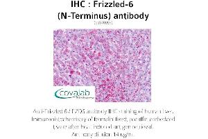 Image no. 2 for anti-Frizzled Family Receptor 6 (FZD6) (Extracellular Domain), (N-Term) antibody (ABIN1734469) (FZD6 antibody  (Extracellular Domain, N-Term))