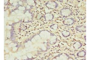 Immunohistochemistry of paraffin-embedded human small intestine tissue using ABIN7173373 at dilution of 1:100 (TCHP antibody  (AA 1-498))