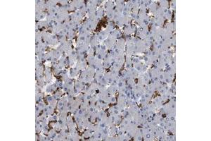 Immunohistochemical staining (Formalin-fixed paraffin-embedded sections) of human liver shows strong cytoplasmic positivity in Kupffer cells with CD300A polyclonal antibody  at 1:20 - 1:50 dilution. (CD300a antibody  (AA 98-149))