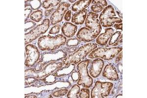 Immunohistochemical staining of human kidney with BCO2 polyclonal antibody  shows strong cytoplasmic positivity in renal tubules at 1:50-1:200 dilution.