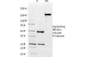 SDS-PAGE Analysis Purified IgD Mouse Monoclonal Antibody (IGD26). (IgD antibody)