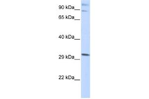 WB Suggested Anti-ZNF148 Antibody Titration:  0.