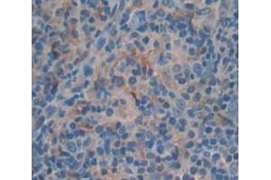 Immunohistochemistry (IHC) image for anti-Actin Related Protein 2/3 Complex, Subunit 4, 20kDa (ARPC4) (AA 3-163) antibody (ABIN1858080)