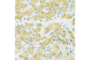Immunohistochemistry of paraffin-embedded human liver using SLC37A4 antibody.