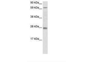 Image no. 1 for anti-Reproductive Homeobox 11 (RHOX11) (AA 61-110) antibody (ABIN6736075) (RHOX11 antibody  (AA 61-110))