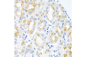 Immunohistochemistry of paraffin-embedded human stomach using CGB antibody. (Chorionic Gonadotropin, beta Polypeptide 3 (CGB3) antibody)