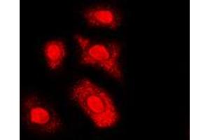Immunofluorescent analysis of AKT (pT308) staining in HL60 cells. (AKT1 antibody  (pSer308))