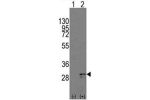 Image no. 2 for anti-KIT Ligand (KITLG) (C-Term) antibody (ABIN357009)