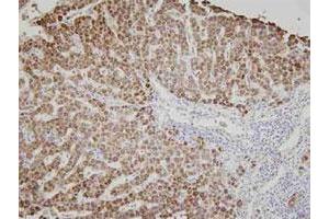 Immunohistochemistry of human liver tissue was incubated with AK3 monoclonal antibody , clone SJB3 - 36 (1 : 100)  for 2 hours at room temperature. (Adenylate Kinase 3 antibody)