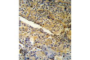 SPINK5 Antibody (N-term) (R) IHC analysis in formalin fixed and paraffin embedded human tonsil tissue followed by peroxidase conjugation of the secondary antibody and DAB staining. (SPINK5 antibody  (N-Term))