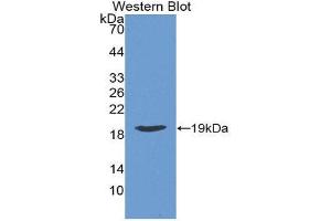 Western Blotting (WB) image for anti-Retinoic Acid Receptor Responder (Tazarotene Induced) 2 (RARRES2) (AA 21-155) antibody (ABIN1862319)