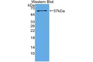 Western blot analysis of the recombinant protein. (Surfactant Protein A1 antibody  (AA 21-248))