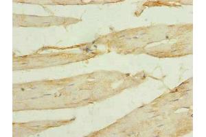 Immunohistochemistry of paraffin-embedded human skeletal muscle tissue using ABIN7175519 at dilution of 1:100 (Vinexin antibody  (AA 1-329))