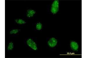 Immunofluorescence of purified MaxPab antibody to NARG2 on HeLa cell. (NARG2 antibody  (AA 1-332))