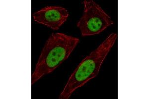 Immunofluorescence (IF) image for anti-Transcription Factor AP-2 delta (Activating Enhancer Binding Protein 2 Delta) (TFAP2D) antibody (ABIN2999809) (TFAP2D antibody)