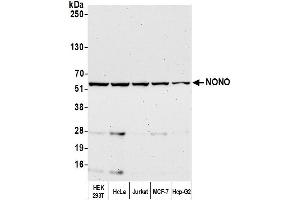 Western Blotting (WB) image for anti-Non-POU Domain Containing, Octamer-Binding (NONO) (AA 1-50) antibody (ABIN7453849) (NONO antibody  (AA 1-50))