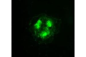 Anti-CDK5 mouse monoclonal antibody (ABIN2452276) immunofluorescent staining of COS7 cells transiently transfected by pCMV6-ENTRY CDK5 (RC200342). (CDK5 antibody)