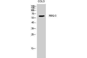 Western Blotting (WB) image for anti-Retinoblastoma Binding Protein 5 (RBBP5) (Internal Region) antibody (ABIN3186713) (RBBP5 antibody  (Internal Region))