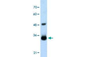 Western Blot analysis of transfected 293T cell lysate with HOXC9 polyclonal antibody  at 2. (HOXC9 antibody  (Internal Region))