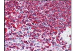Human Spleen: Formalin-Fixed, Paraffin-Embedded (FFPE) (GDI2 antibody)