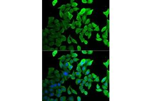 Immunofluorescence analysis of U2OS cells using Septin 2 antibody (ABIN6128758, ABIN6147552, ABIN6147553 and ABIN6221486). (Septin 2 antibody  (AA 112-361))