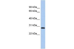 WB Suggested Anti-LYSMD1 Antibody Titration: 0.