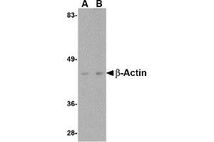 Western Blotting (WB) image for anti-Actin, beta (ACTB) (C-Term) antibody (ABIN1030291) (beta Actin antibody  (C-Term))