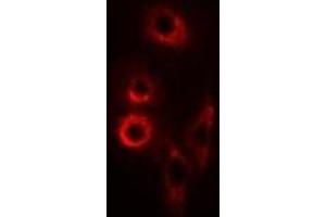 Immunofluorescent analysis of SMAC staining in SW620 cells. (DIABLO antibody)