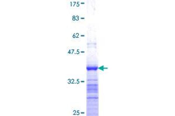 LASS3 Protein (AA 57-134) (GST tag)