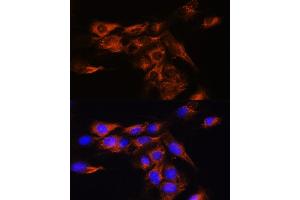 Immunofluorescence analysis of C6 cells using B Rabbit pAb (ABIN7265455) at dilution of 1:100. (Adenosine A2b Receptor antibody  (AA 100-200))