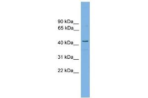 Host:  Rabbit  Target Name:  RDH16  Sample Tissue:  Human COLO205 Whole Cell  Antibody Dilution:  1ug/ml